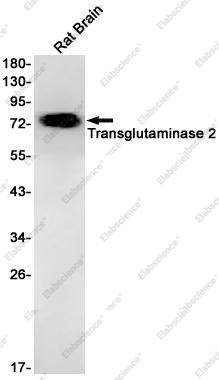 Recombinant Transglutaminase 2 Monoclonal Antibody - 1