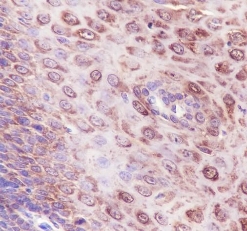 Recombinant IL-1RA Monoclonal Antibody - 2