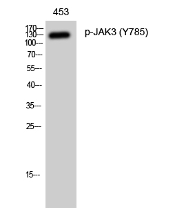 Western Blot analysis of 453 cells with Phospho-JAK3 (Tyr785) Polyclonal Antibody at dilution of 1:1000