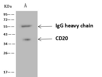CD20/MS4A1 Monoclonal Antibody - small - 5