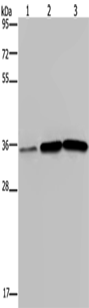 Western Blot analysis of Human testis tissue, A549 and PC3 cell using MAGEA3 Polyclonal Antibody at dilution of 1:400