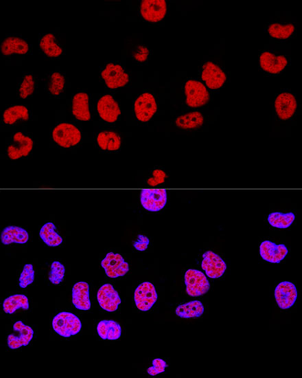 Confocal immunofluorescence analysis of Hela cells using CTCF Polyclonal Antibody at dilution of  1:100. Blue: DAPI for nuclear staining.