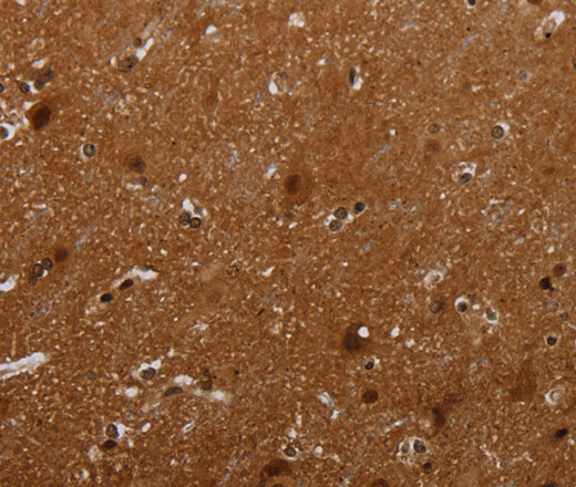 Immunohistochemistry of paraffin-embedded Human brain  tissue using MAGEB18 Polyclonal Antibody at dilution 1:30