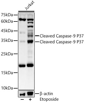 Western blot analysis of extracts of Jurkat using Cleaved Caspase-9 P37 Polyclonal Antibody at 1:1000 dilution.Jurkat cells were treated by Etoposide (25 uM) at 37°C for 5 hours.