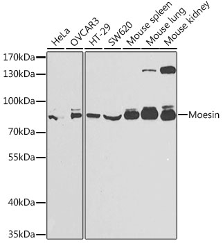 Western blot analysis of extracts of various cell lines using Moesin Polyclonal Antibody at 1:1000 dilution.