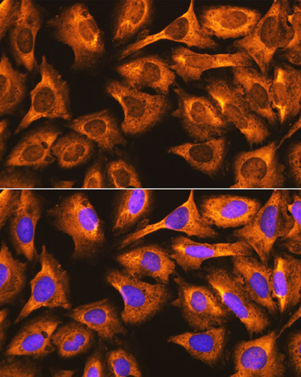 Immunofluorescence analysis of U-2 OS cells using RPS3 Polyclonal Antibody at dilution of  1:100. Blue: DAPI for nuclear staining.