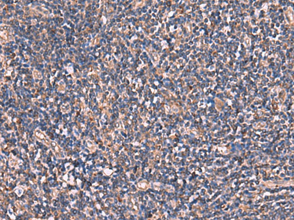 Immunohistochemistry of paraffin-embedded Human tonsil tissue  using TTC38 Polyclonal Antibody at dilution of 1:85(?200)