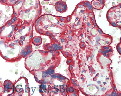 CLTC Polyclonal Antibody - 5