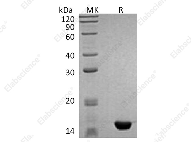 Recombinant Human MAP1LC3B Protein - 1