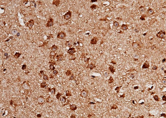 Recombinant LIMP-2/SCARB2/CD36L2 Monoclonal Antibody - small - 2