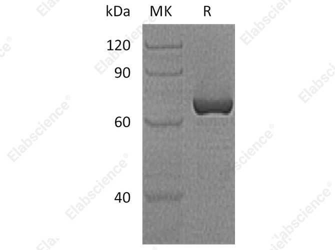 Recombinant Human Vaspin/SerpinA12 Protein (GST Tag) - 1
