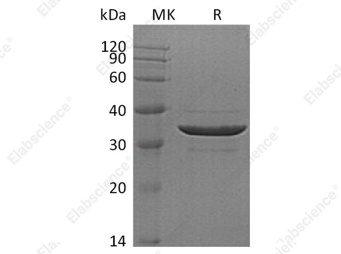 Recombinant Human ACYP2 Protein (GST Tag) - 1