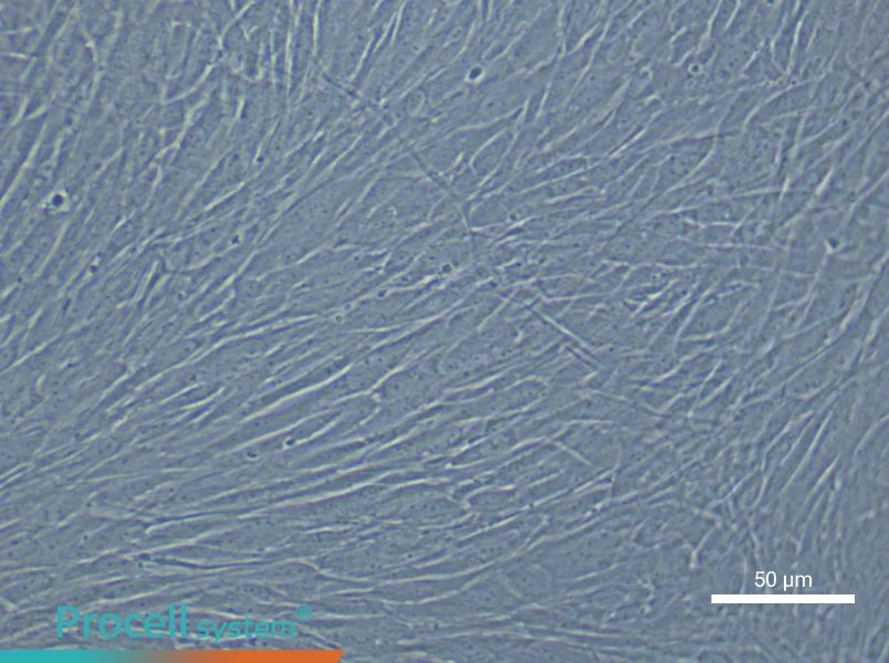 Human Cerebral Artery Smooth Muscle Cell Complete Medium - 6