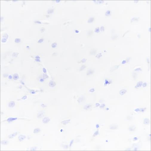 Recombinant UCP1 Monoclonal Antibody - small - 3