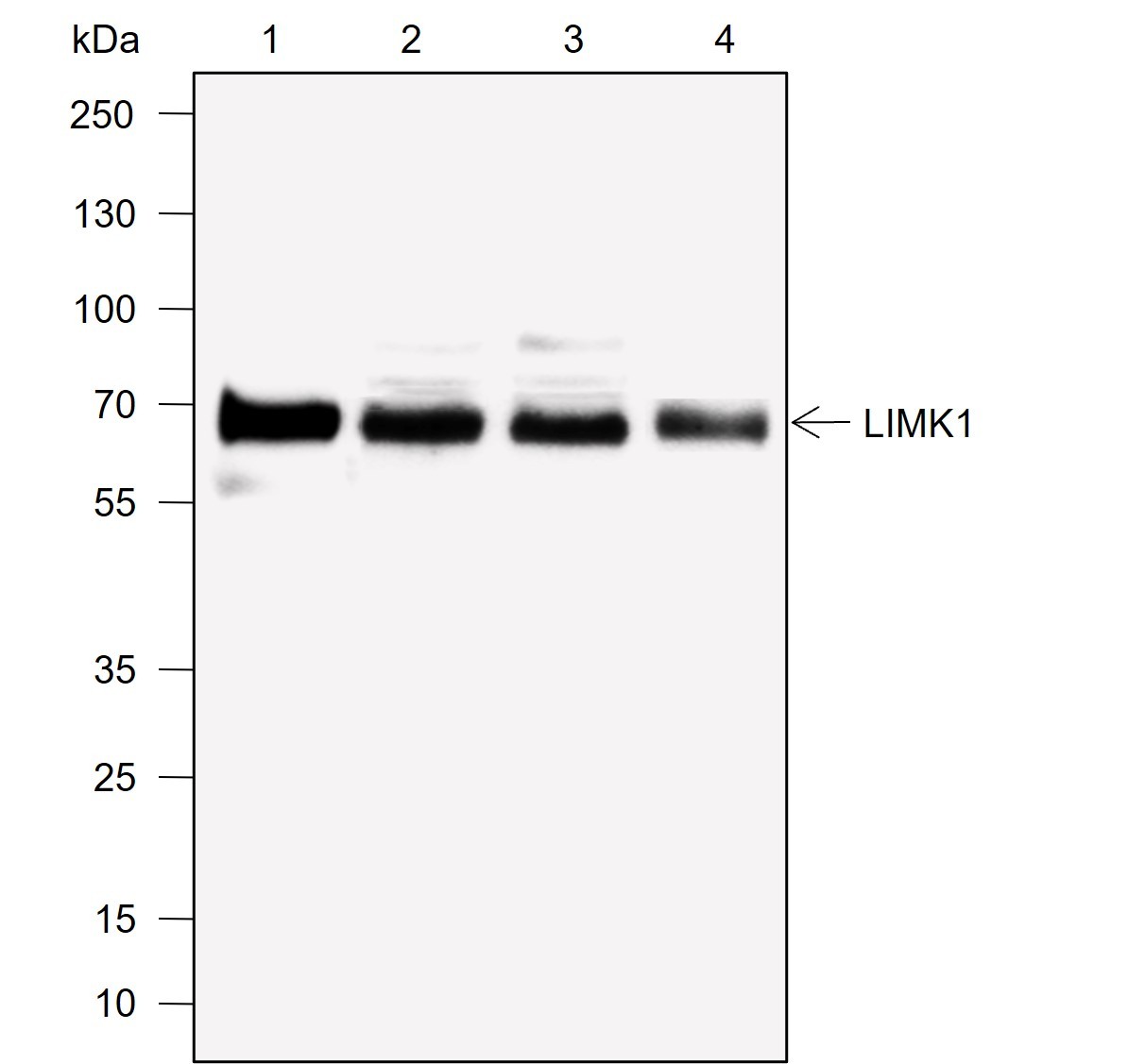 Recombinant LIMK1 Monoclonal Antibody-searchlist-1