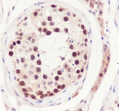 Recombinant FEN1 Monoclonal Antibody - small - 4