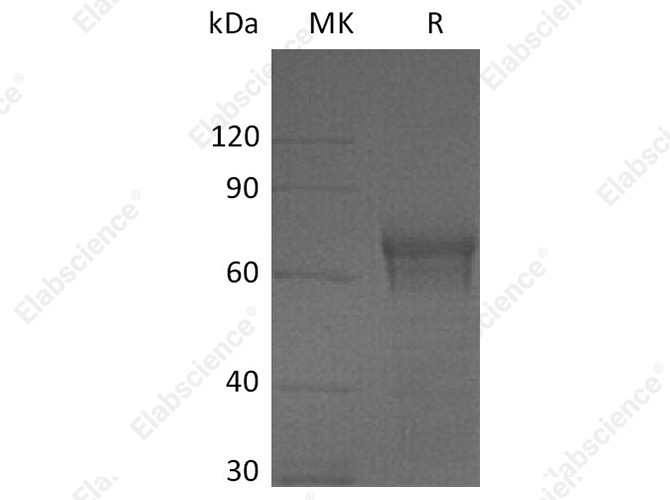 Recombinant Human IL15RA/IL-15RA Protein (Fc Tag) - 1