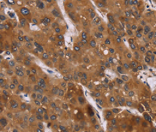 PPIB Polyclonal Antibody - 3