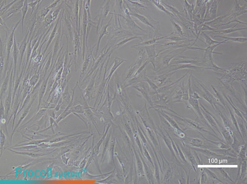 Human Synovial Fibroblast (rheumatoid arthritis) Complete Medium - 3