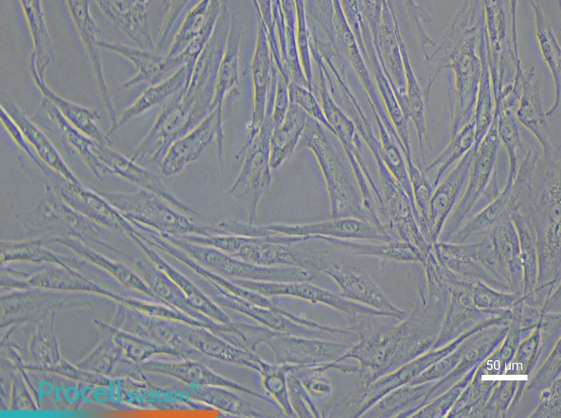 Human Uterine Fibroids Tissue-Derived Cell Complete Medium - 5
