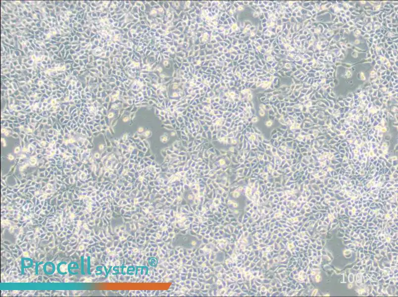 RT-112 Cell Complete Medium - 3