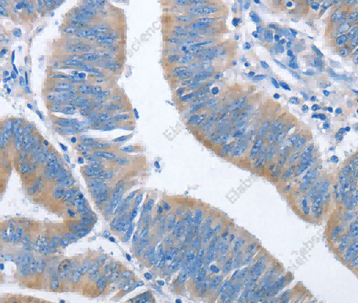 NCAPD2 Polyclonal Antibody - 3