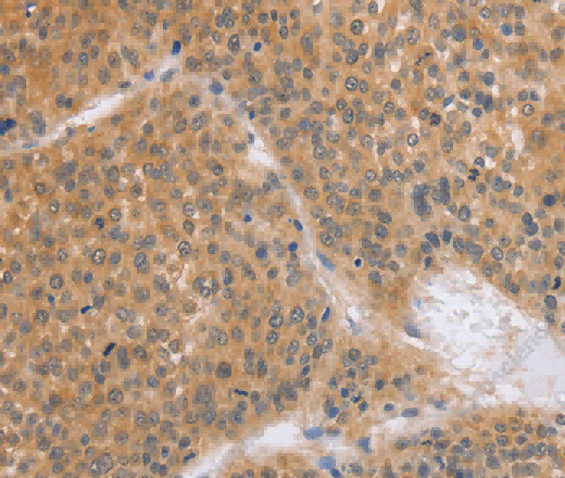BRS3 Polyclonal Antibody - 2