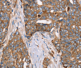 FUCA1 Polyclonal Antibody - 2