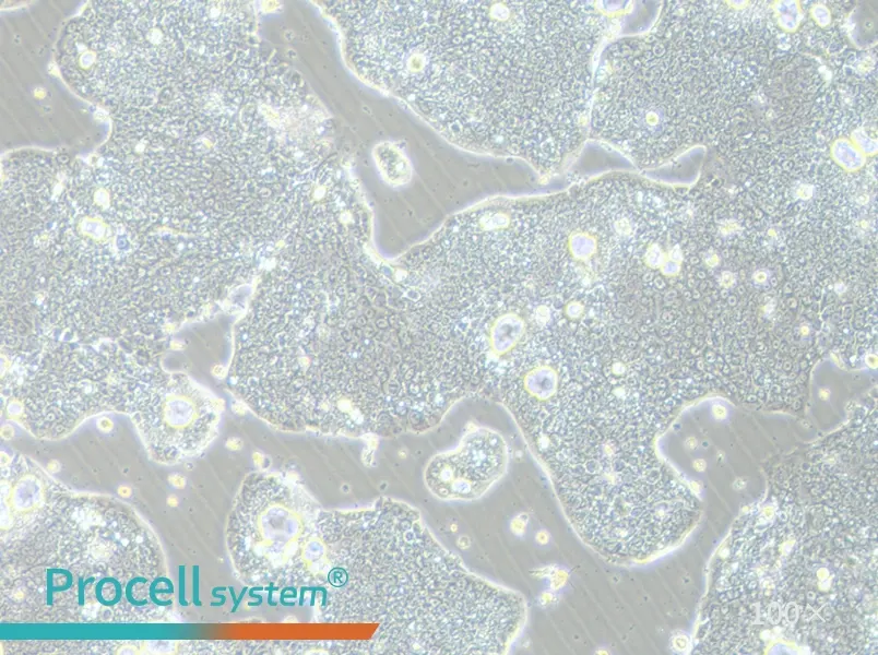 NCI-N87 [N87] Cell Complete Medium - 3