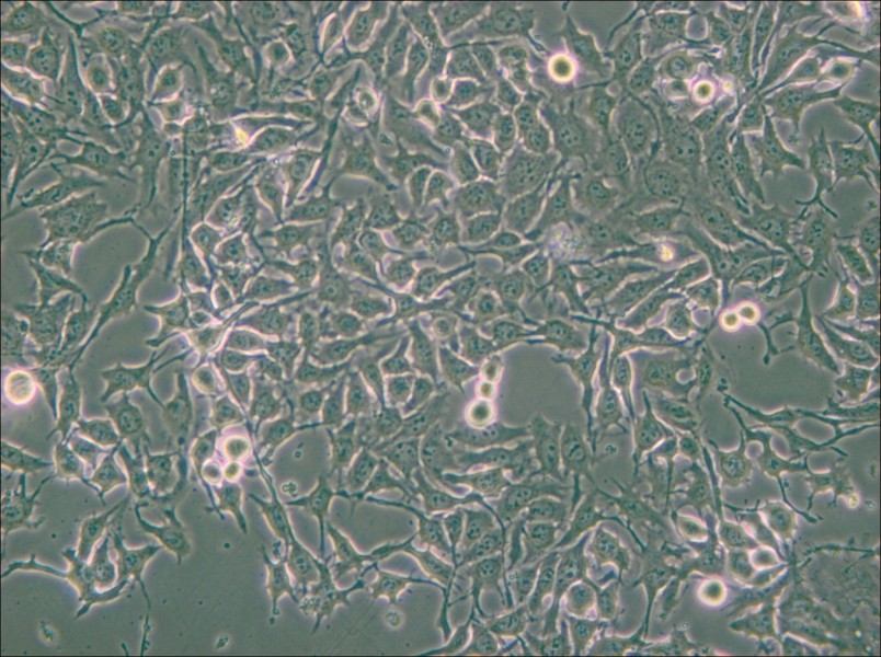 NCI-H3122 Cell Complete Medium - small - 5