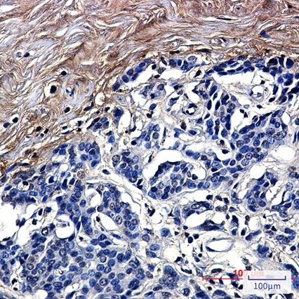 Recombinant CLEC3B/Tetranectin Monoclonal Antibody - 3