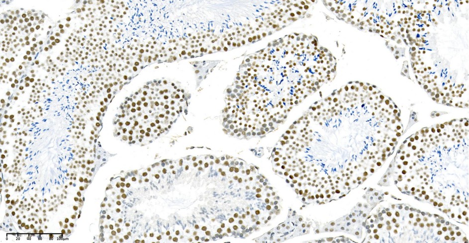 Recombinant METTL3 Monoclonal Antibody - small - 4