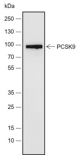 Recombinant PCSK9 Monoclonal Antibody-searchlist-1