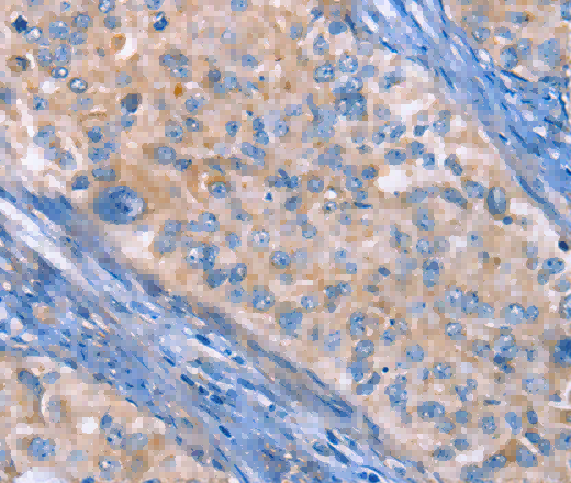CD61 Polyclonal Antibody - 3