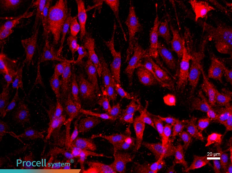 Rat Cavernous Endothelial Cell Complete Medium - 2