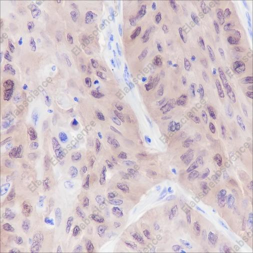 Recombinant ALDH3A1 Monoclonal Antibody - 3