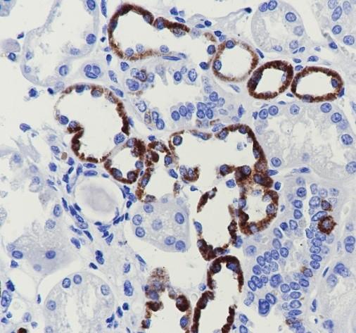 Recombinant CPT1B Monoclonal Antibody - small - 3