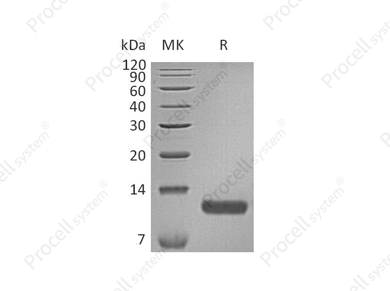 TARC/CCL17 (C-6His), Human, Recombinant
