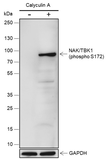 Recombinant Phospho-TBK1/NAK (Ser172) Monoclonal Antibody - small - 2