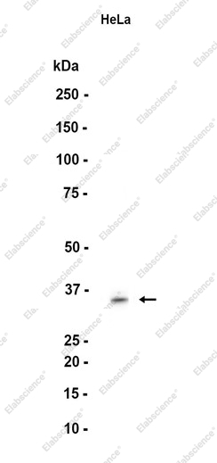Recombinant MBD3 Monoclonal Antibody - 1