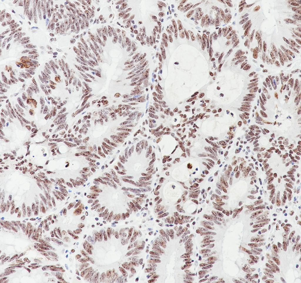 Recombinant MORF4L2 Monoclonal Antibody - small - 3
