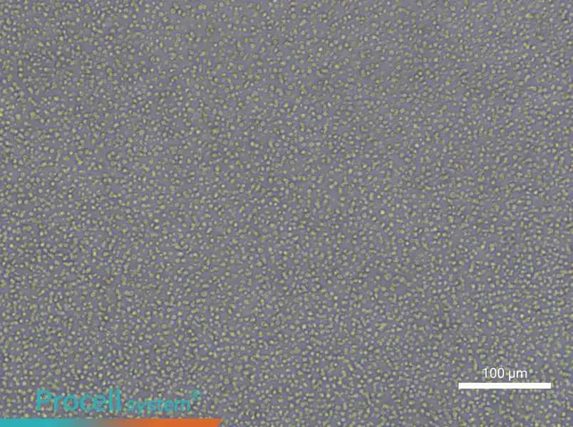 CCRF-CEM [CCRF CEM] - 1