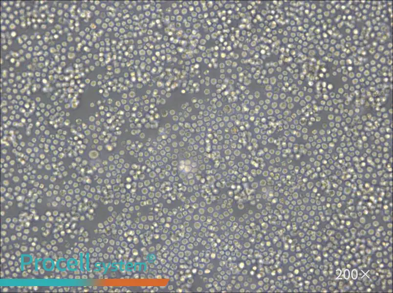 DoHH2 Cell Complete Medium - 4