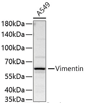 (KO Validated) Vimentin Polyclonal Antibody - small - 9