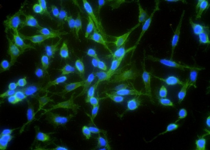 Recombinant N-Cadherin/CD325/CDH2 Monoclonal Antibody - small - 2