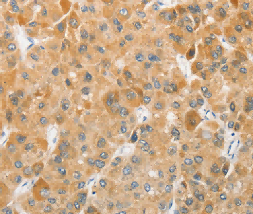 ATG5 Polyclonal Antibody - 3