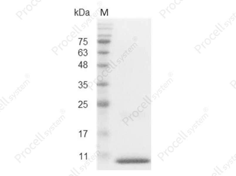 CXCL1/GRO-&alpha;/NAP-3/GRO1, Human, Recombinant