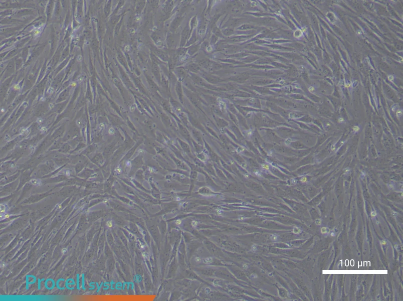 Human Aortic Smooth Muscle (Primary cell immortalization) Cell Complete MediumHuman Aortic Smooth Muscle (Primary cell immortalization) Cell Complete Medium - 2