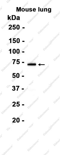 Recombinant ALOX15 Monoclonal Antibody - 1