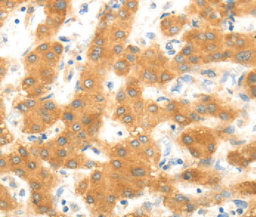 MAP2K6 Polyclonal Antibody - 2